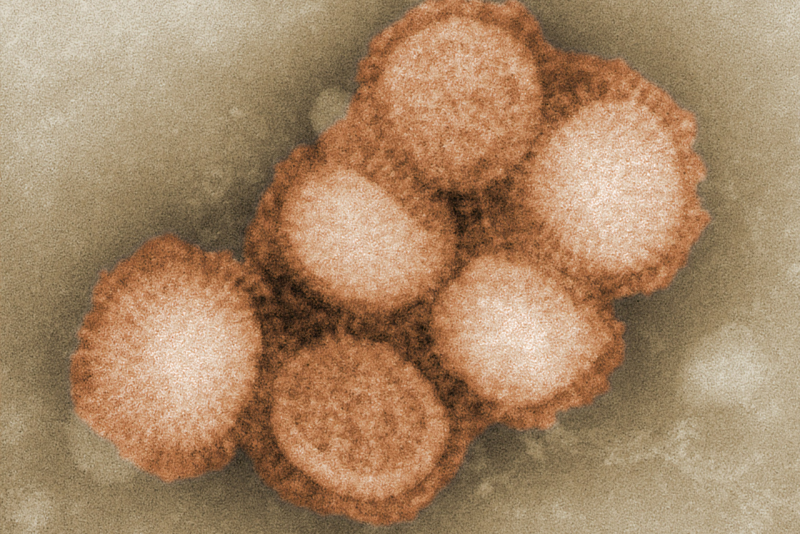 monkeypox